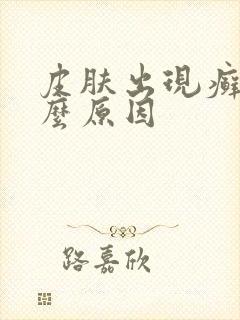 皮肤出现癣是什么原因