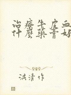 治疗牛皮血癣用什么药膏好