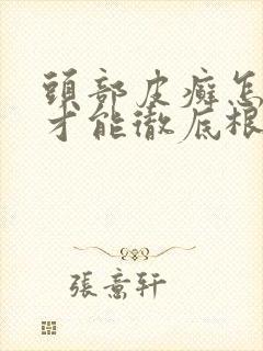 头部皮癣怎么治才能彻底根除