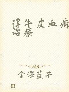 得牛皮血癣怎么治疗
