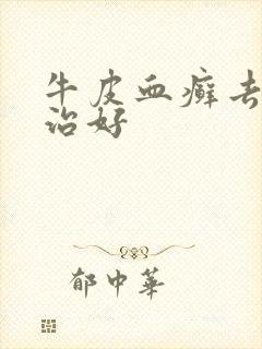 牛皮血癣去哪里治好