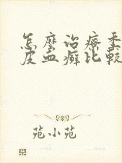怎么治疗季节牛皮血癣比较好
