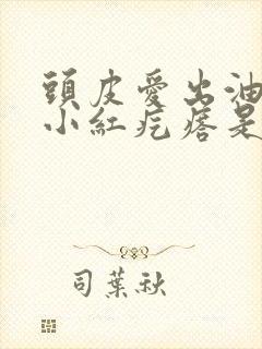头皮爱出油还有小红疙瘩是怎么回事