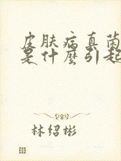 皮肤病真菌感染是什么引起的封面