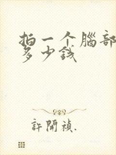 拍一个脑部ct多少钱