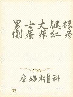 男士大腿根部内侧瘙痒红疹用什么药封面