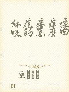 红疙瘩痒像蚊子咬的怎么回事