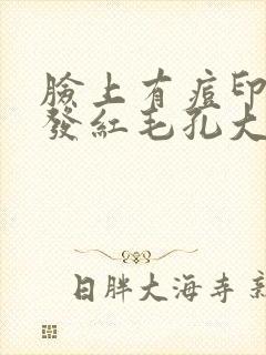 脸上有痘印痘痘发红毛孔大怎么办封面