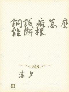 铜钱癣怎么治才能断根封面