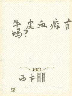 牛皮血癣有得治吗?