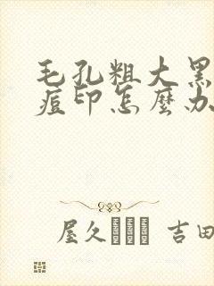 毛孔粗大黑头多痘印怎么办