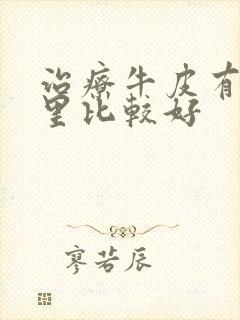 治疗牛皮有癣哪里比较好