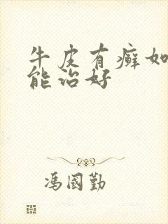 牛皮有癣如何才能治好