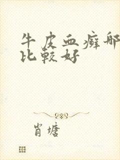 牛皮血癣哪里治比较好