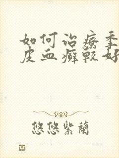 如何治疗季节牛皮血癣较好