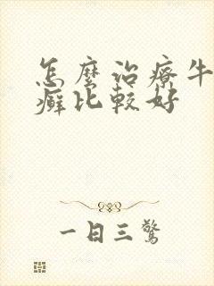 怎么治疗牛皮有癣比较好