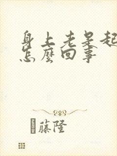 身上老是起癣是怎么回事