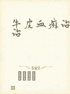 牛皮血癣治疗医治