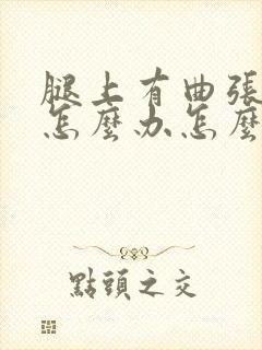 腿上有曲张静脉怎么办怎么治的好