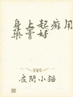 身上起癣用什么药膏好