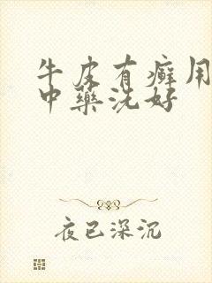 牛皮有癣用什么中药洗好