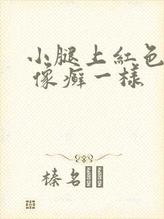 小腿上红色圆圈 像癣一样