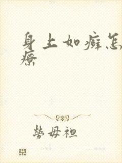 身上如癣怎么治疗封面