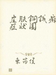 皮肤铜钱癣初期症状图