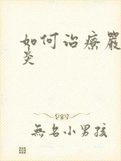 如何治疗严重胃炎
