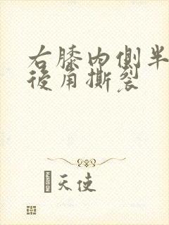 右膝内侧半月板后角撕裂