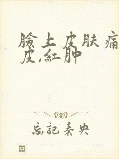 脸上皮肤痛,脱皮,红肿