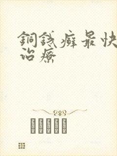 铜钱癣最快土方治疗