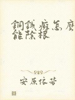 铜钱癣怎么治才能除根