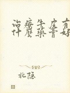治疗牛皮有癣用什么药膏好