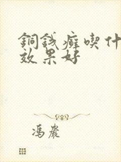 铜钱癣吃什么药效果好
