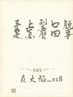 手上裂口脱皮痒是怎么回事