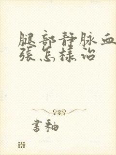 腿部静脉血管曲张怎样治