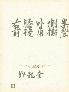 右膝外侧半月板前后角撕裂