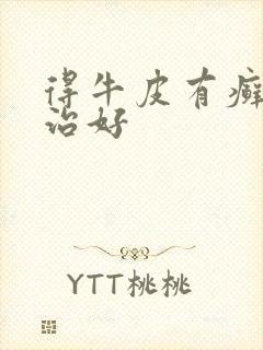 得牛皮有癣如何治好