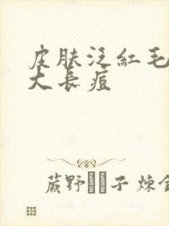 皮肤泛红毛孔粗大长痘封面