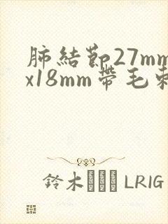 肺结节27mmx18mm带毛刺分叶